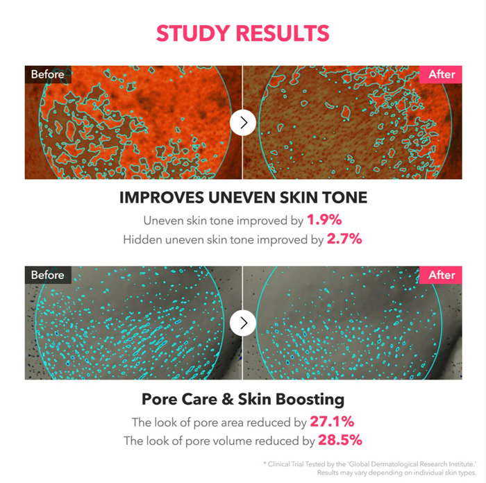 Aprilskin TXA Niacinamide Toning Shot 99 Serum - 30ml