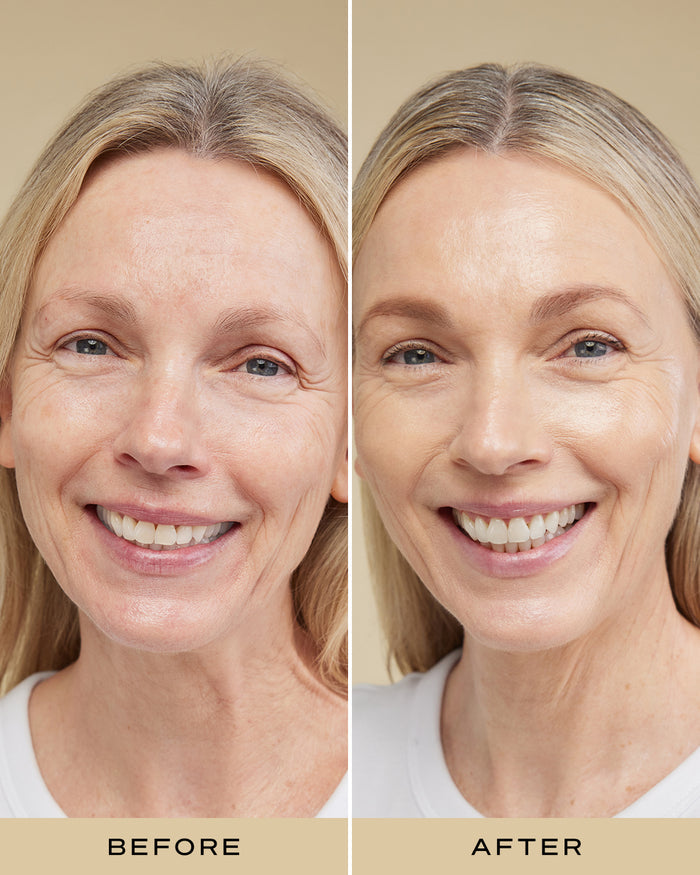 BBB CREAM SPF 30+ LIGHT b&a