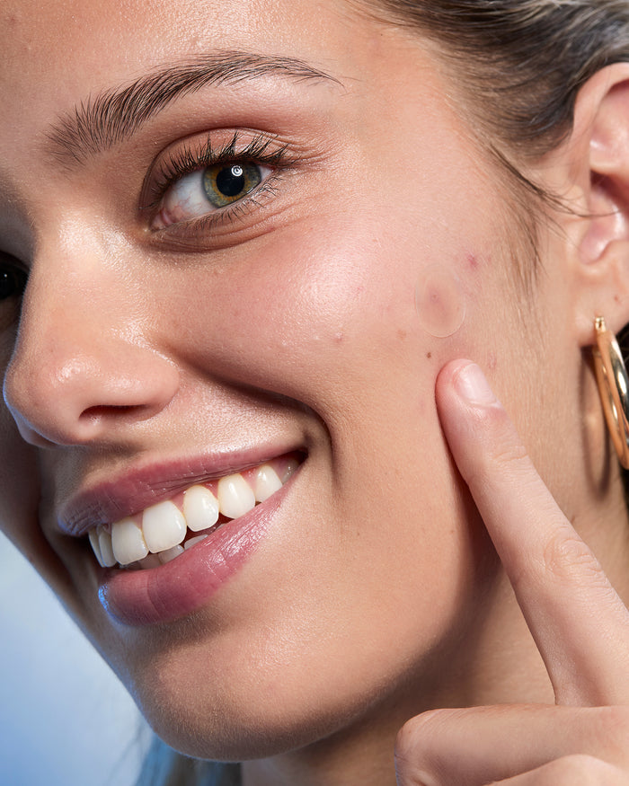 Clear Pimple Patch Kit