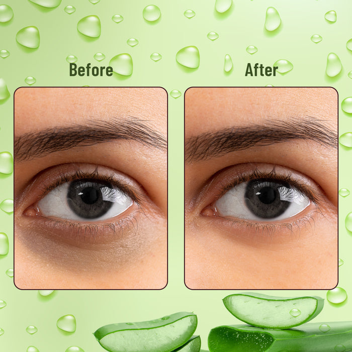 Hydra Eye Serum Patch with Aloe Vera