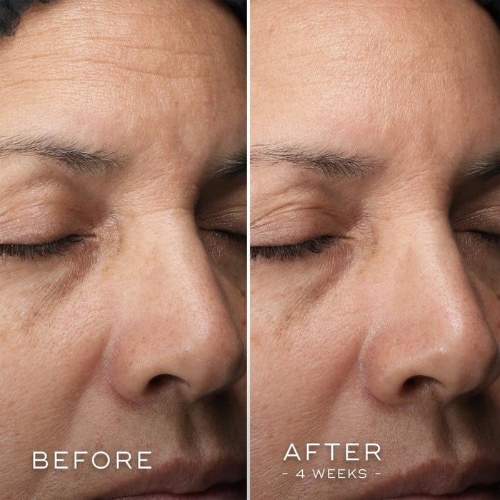 Medik8 C-Tetra Luxe 30ml