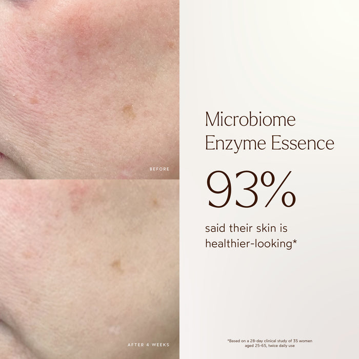 True Botanicals-Renew Microbiome Enzyme Essence-Skincare-BA1_Essence_2048x2048_0fbe18ff-a9bc-4b00-8a07-408f5ca8ba36-The Detox Market |