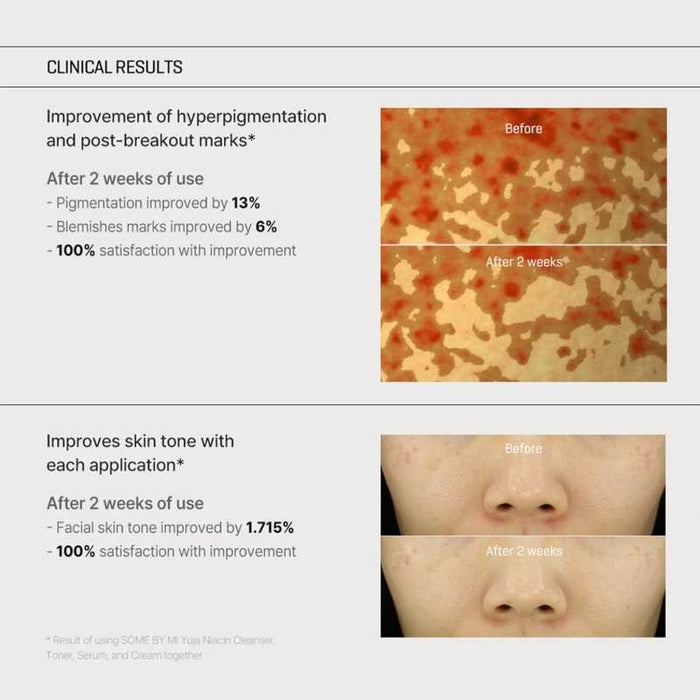 SOME BY MI Yuja Niacin Anti Blemish Cream 60ml